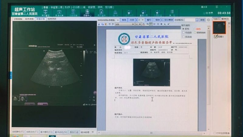血常规指标揭秘：它们背后的健康密码